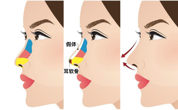重慶軍科林勇做鼻子怎么樣?從個人簡歷看他隆鼻技術先進價格值 9l制片厂在线观看永久
